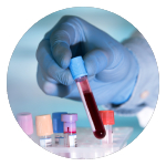 Microplastiche nel sangue